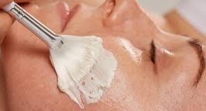 Tratamiento Peeling